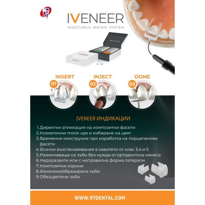 IVENEER